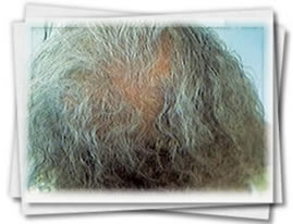 Clínica do Cabelo Matriz