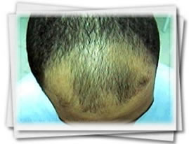 Clínica do Cabelo Matriz