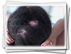 Clínica do Cabelo Matriz