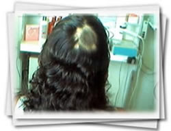 Clínica do Cabelo Matriz