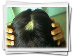 Clínica do Cabelo Matriz