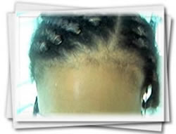 Clínica do Cabelo Matriz