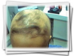 Clínica do Cabelo Matriz