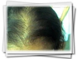 Clínica do Cabelo Matriz