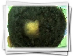 Clínica do Cabelo Matriz