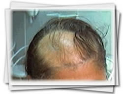Clínica do Cabelo Matriz
