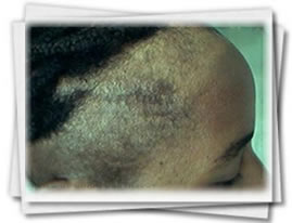 Clínica do Cabelo Matriz