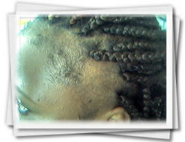 Clínica do Cabelo Matriz